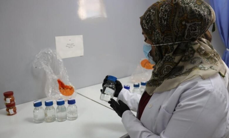 صورة خلال عام 2020.. مختبر الصحة العامة المركزي ينجز حوالي 750 ألف فحص