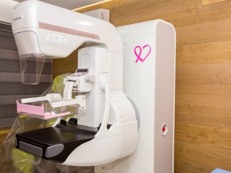 جهاز فحص الثدي