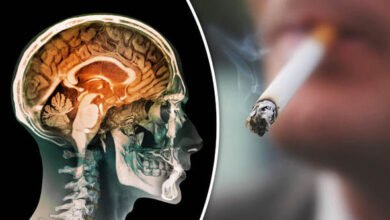 صورة دراسة صادمة: التدخين اليومي يقلّص من حجم الدماغ